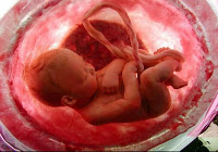 bebe intrauterino