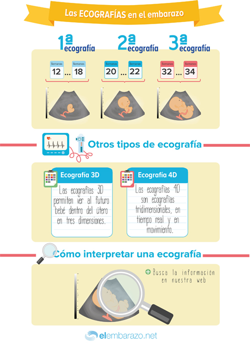 ecografías