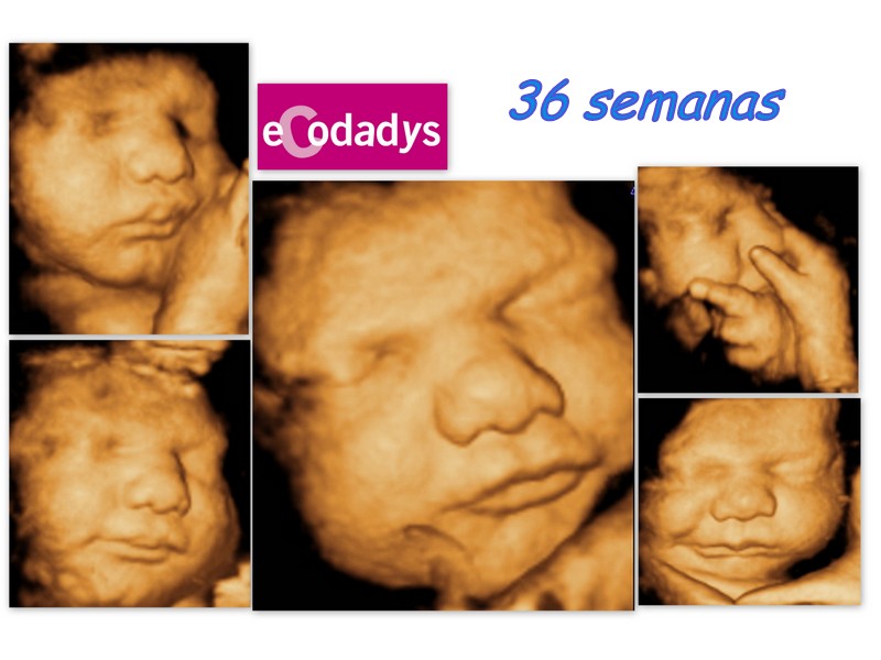 ecografias-4d-jaen