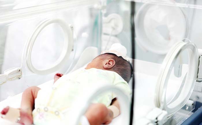 Dudas sobre los bebés prematuros